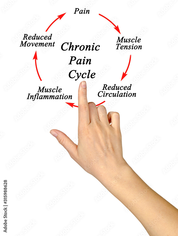 Steps in Chronic Pain Cycle Steps in Chronic Pain Cycle