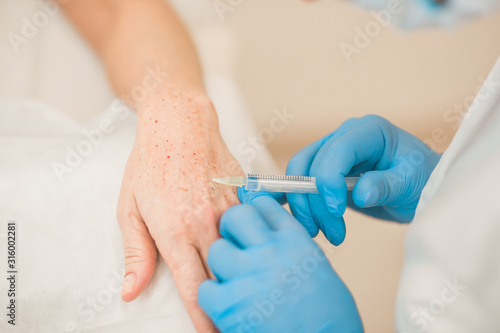 Hands of a cosmetologist during an operation biorevitalization of the skin of the hands of an aged woman - close-up