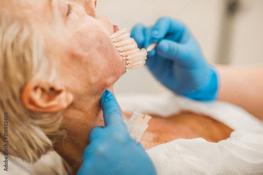 PDO Thread Lift is a treatment which lifts and tightens sagging skin tissue - doctor’s hands close-up PDO Thread Lift is a treatment which lifts and tightens sagging skin tissue - doctor’s hands close-up