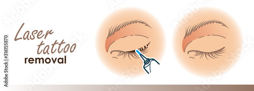 Eyeliner removal procedure illustration. Laser tattoo removal icons, microblading