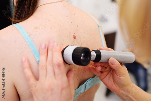 Foto Doctor examining birthmarks and moles patient
