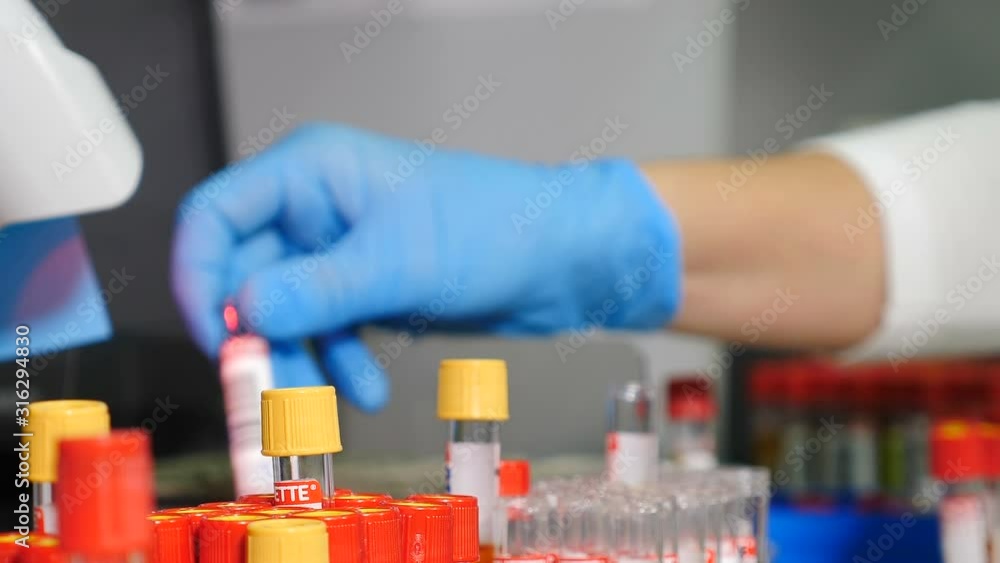 Research in laboratory, medical worker installs test tubes with samples of blood and urine in form. Hands close up. Medical tests. Clinical diagnostic laboratory equipment. 4k video Research in laboratory, medical worker installs test tubes with samples of blood and urine in form. Hands close up. Medical tests. Clinical diagnostic laboratory equipment. 4k video