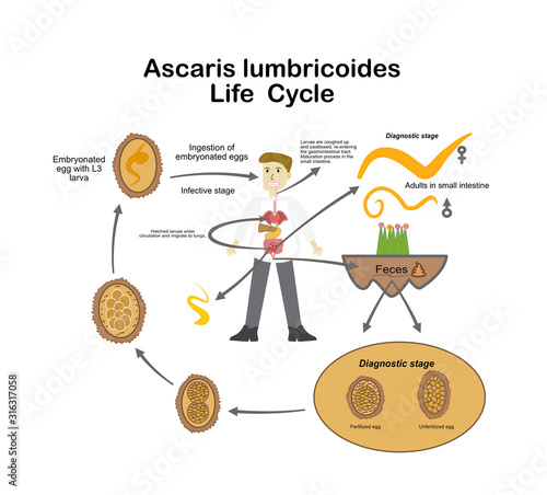 Ascaris lumbricoides.Medical Parasitology.Parasitic microscope.