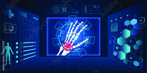 Medical orthopedic abstract background. Treatment for orthopedics traumatology of hand bones and joints injury. Medical presentation, hospital. Vector illustration