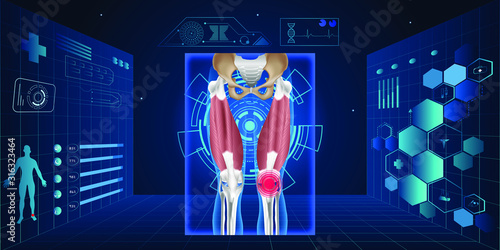 Treatment for knee osteoarthritis future medical scheme. Medications Administration with a syringe needle to damaged Joint and healthy Knee Anatomical.Vector illustration