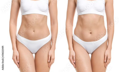 Young woman before and after plastic operation on white background