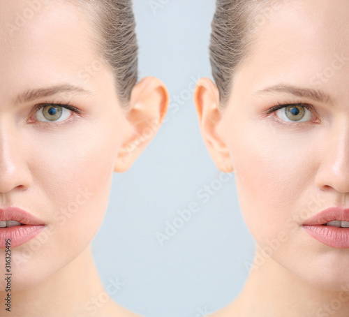 Young woman before and after plastic operation on light background, closeup photo