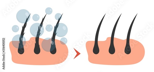 active ingredient treatment deep into hair and scalp.Hair care serum vector . Treatment design template with place for your text. Hair care , prevent split ends vector illustration