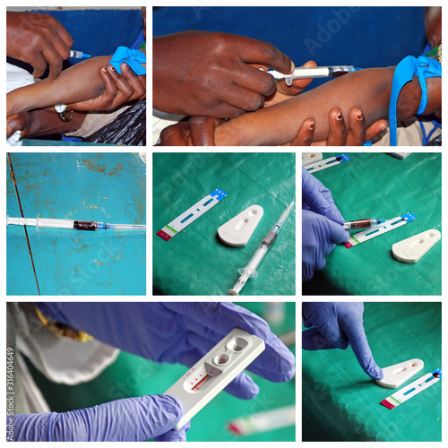 Laboratory analysis of the AIDS virus in Pomerini Village in Tanzania - Africa photo