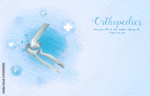 Medical orthopedic watercolor background. Treatment for orthopedics traumatology of elbow bones and joints injury. Medical presentation, hospital. Vector illustration