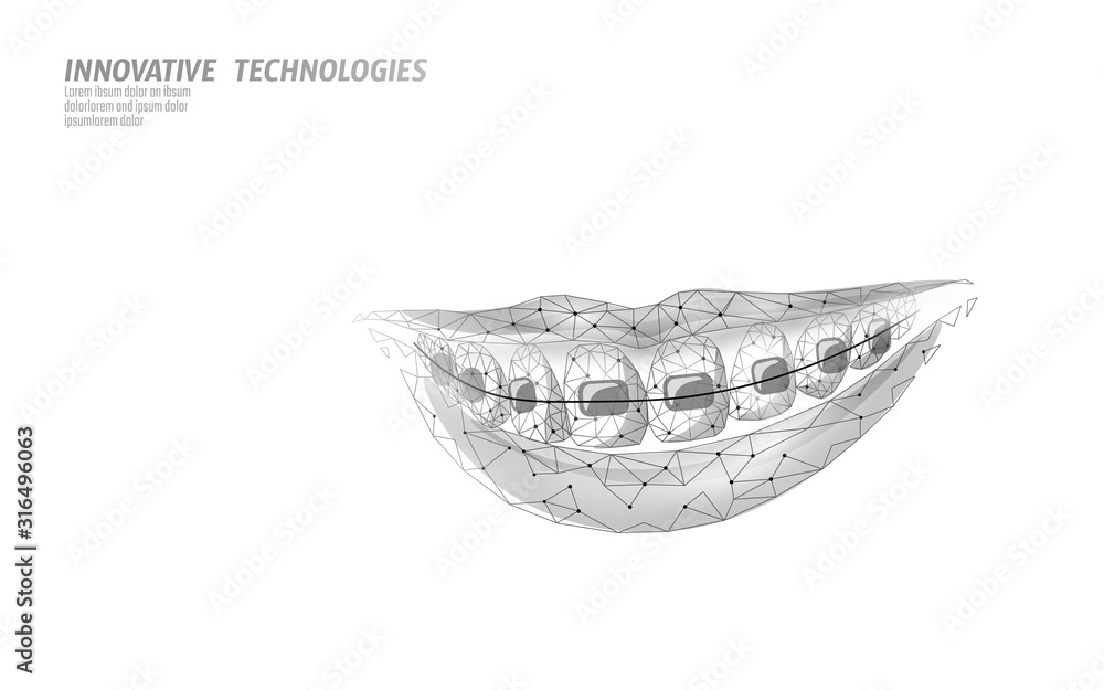 Obraz premium 3D orthodontic braces. Wonam smile tooth trainer. Dental theatment heath care medical banner. Low poly design dentist correction fix vector illustration