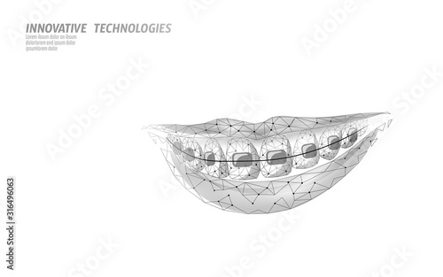 3D orthodontic braces. Wonam smile tooth trainer. Dental theatment heath care medical banner. Low poly design dentist correction fix vector illustration