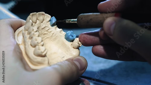 The dentist doctor makes a denture on the jaw. The dentist holds a jaw implant in his hands and applies the material with tools. Modern technologies in dentistry. Close-up, 4k. photo