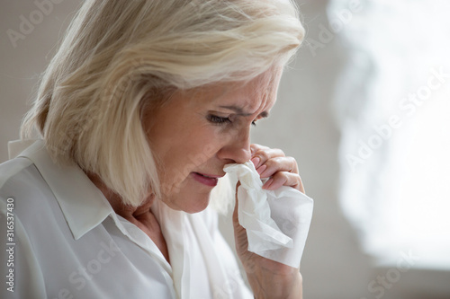 Fotografie Aged woman holding napkin blows runny nose need antiviral medication