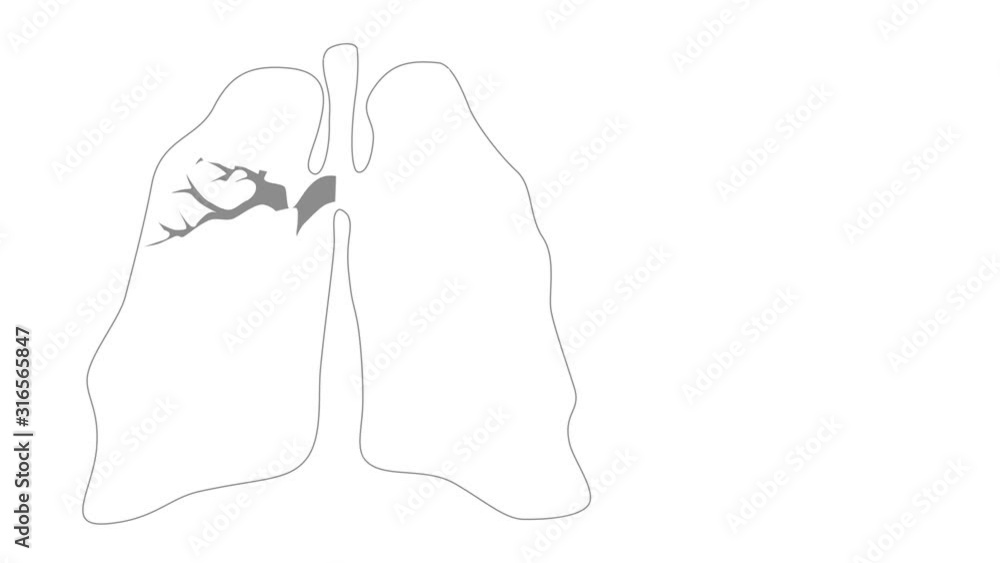 Self drawing sketch animation of human lungs. Concept of breathing, air consumption and health. Copy space. White foggy background. Self drawing sketch animation of human lungs. Concept of breathing, air consumption and health. Copy space. White foggy background.
