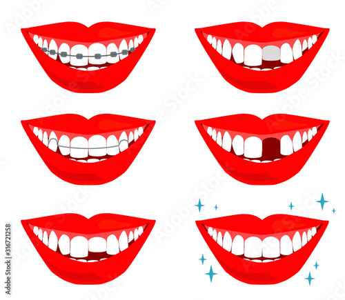 Smile with teeth on a white background. Dentistry Vector illustration. 