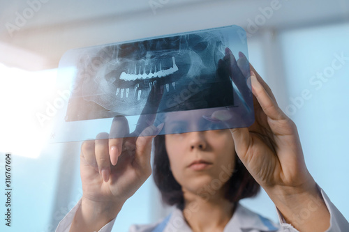 Close up picture of young woman doctor dentist who analysis dental x ray orthopantomogram. Dental panoramic radiography photo