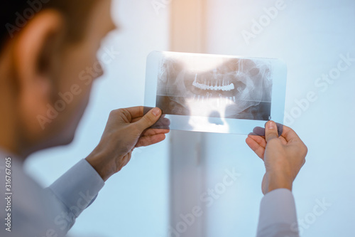 Close up picture of young man doctor dentist who analysis dental x ray orthopantomogram. Dental panoramic radiography