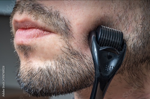 Facial hair care concept. Young man is using derma roller on beard. photo