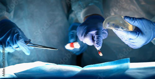 Close-up of physicians hands performing medical breast reconstruction procedure. Specialist holding silicone implants in hand. Breast augmentation concept photo