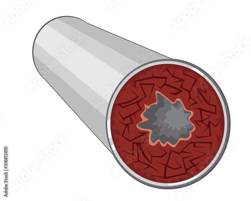A cutaway pipe and a blockage of a plastic or metal pipe is isolated on a white background for design, A vector stock illustration with blockade of plumbing as a concept of pipe problems