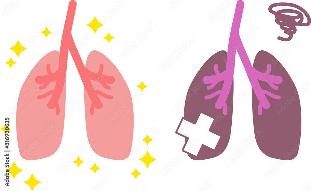シンプルな健康 不健康な肺のイラスト 内臓 消化器 Stock Vector Adobe Stock