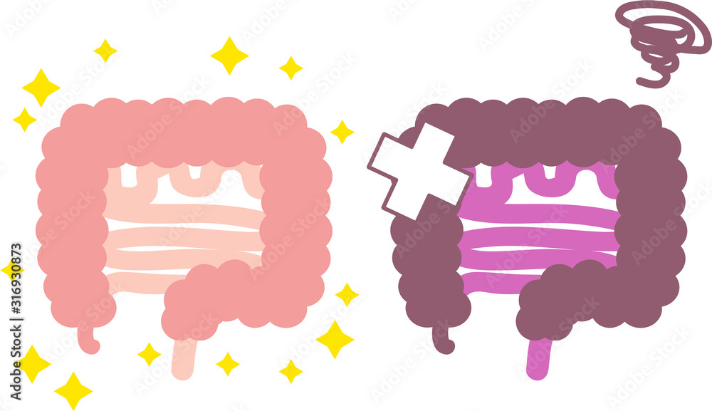 シンプルな健康 不健康な腸のイラスト 内臓 消化器 Stock Vector Adobe Stock