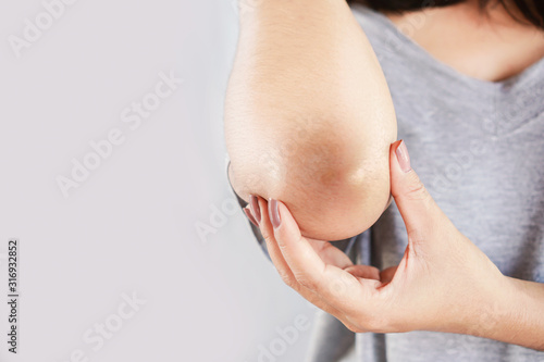 Quadro em tela woman having problem with dry,damage and dark skin on elbow closeup