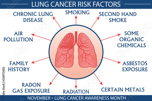 Lung cancer risk factor infographic vector illustration. Health and healthcare concept design for presentation, banner, brochure, etc. EPS-10 vector, printable cmyk colors.