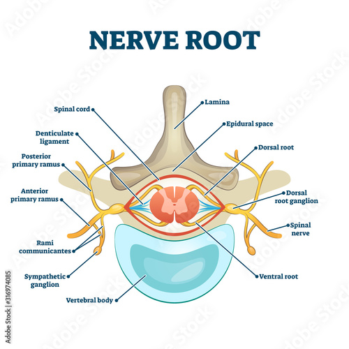 Nerve root anatomical structure labeled cross section photo