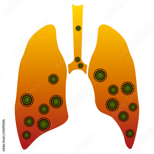 Silhouette of human lungs with a virus. Pneumonia. Vector illustration