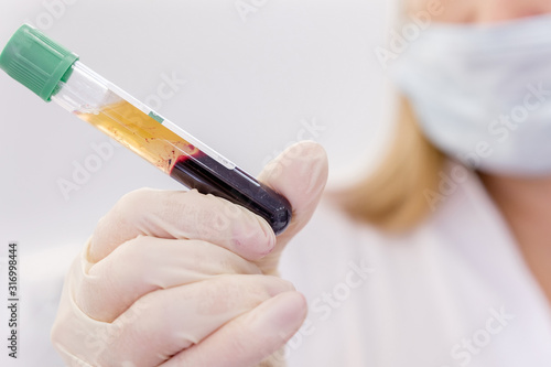Young attractive doctor with mask on face in scrub and gloves holds in hand test tube with separated plasma from the patient's blood. Blood plasma treatment, plasmolifting. Female medic professional photo
