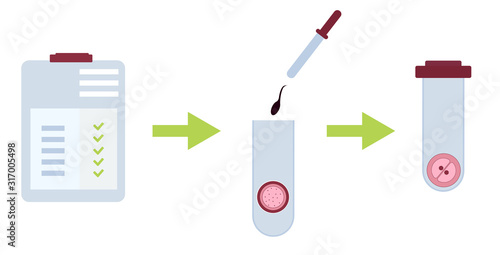 stages of in vitro fertilization Protocol. Flat. results are good, then the Union of sperm and ovum, then the zygote in vitro.