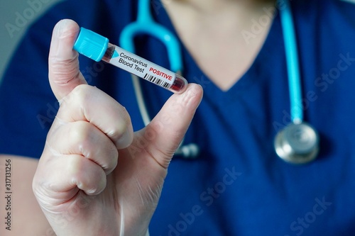 Nurse holding a positive blood test result for the new rapidly spreading Coronavirus, originating in Wuhan, China