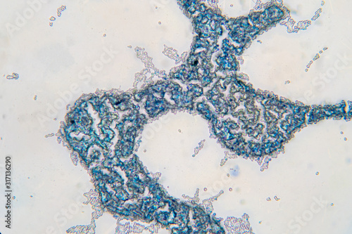 Obraz na płótnie Saccharomyces cerevisiae yeast budding cell under microscope.