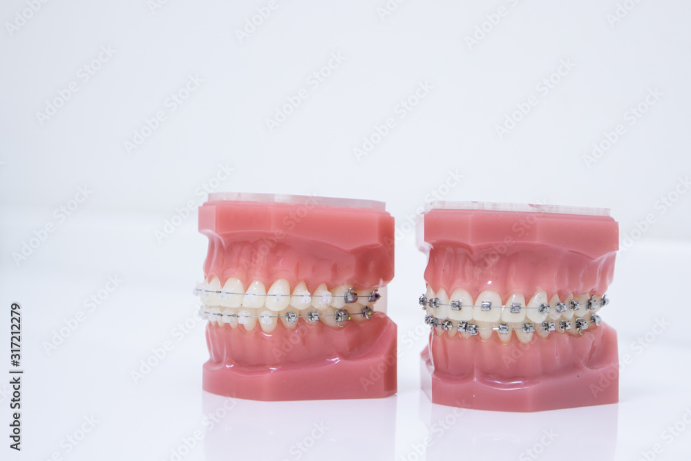 Close up tooth model / mock tooth in dental clinic. Mock tooth or tooth model is used by dentist to demonstrate how human teeth & jaw works. Dental care and dentist 's equipment concept. Copy space. Close up tooth model / mock tooth in dental clinic. Mock tooth or tooth model is used by dentist to demonstrate how human teeth & jaw works. Dental care and dentist 's equipment concept. Copy space.