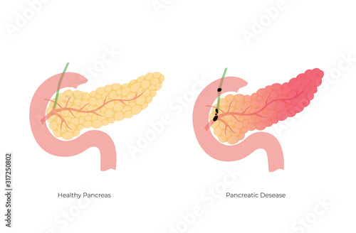 Vector isolated illustration of pancreas