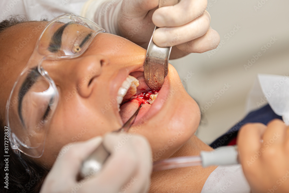 Young woman being seen in a dentist's office. Concept of toothache, wisdom tooth extraction, anesthesia, problems with caries or gums. Oral health care. Dentist day.