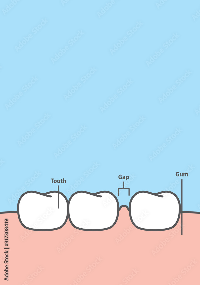 Teeth Frame Blank banner Diastema teeth frame cartoon style for info or book ...
