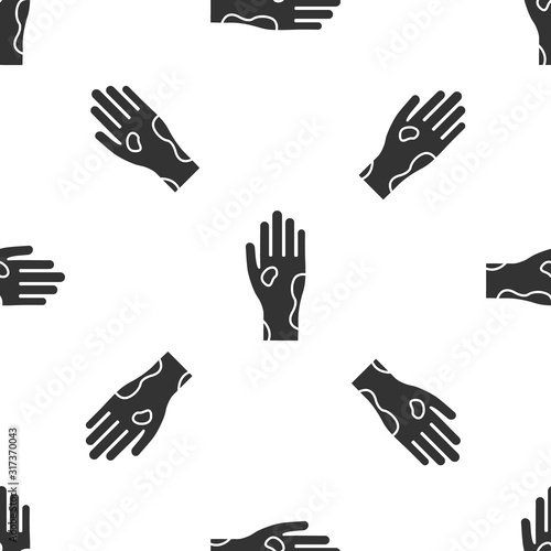 Grey Hand with psoriasis or eczema icon isolated seamless pattern on white background. Concept of human skin response to allergen or chronic body problem. Vector Illustration