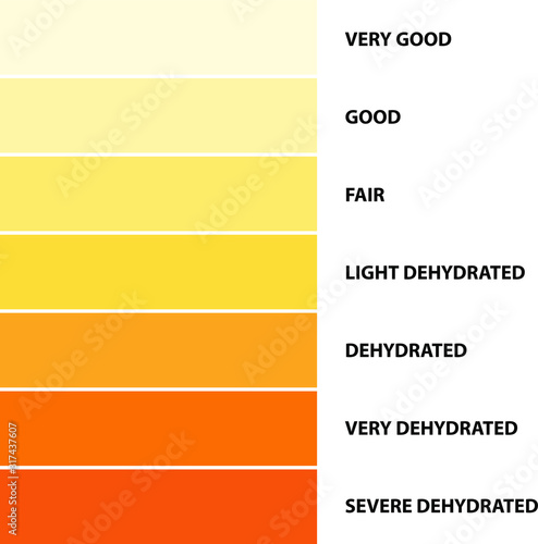 Urine color, Dehydration Urine Color Chart, vector illustration