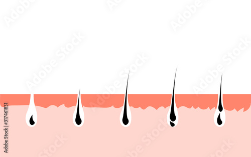 Hair growth cycle skin. Follicle anatomy anagen phase, hair growth diagram illustration