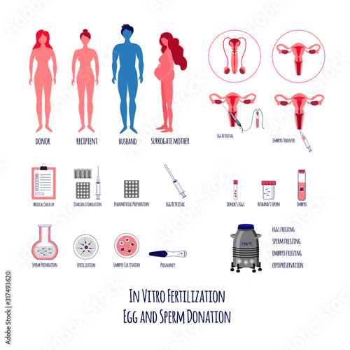 In vitro Fertilization Big Set. Egg retrieval and donation. Embryo cultivation and transfer. Surrogacy and Pregnancy. Vector illustration. 