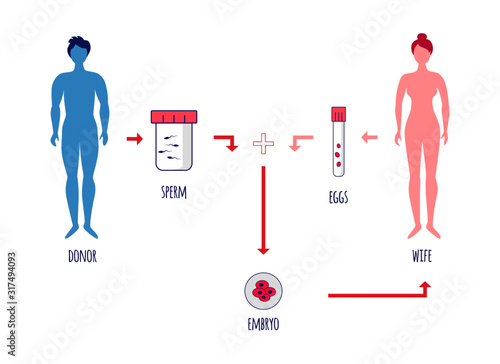 Sperm donation. Scheme of sperm donation procedure. Bank of sperm. Embryo. IVF. Vector illustration.