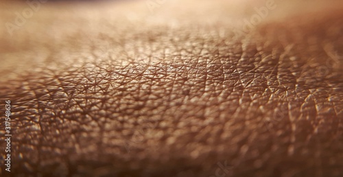 Skin diseases concept. macro skin of human hand.Medicine and dermatology concept. Details of human skin background. photo