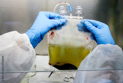 Placental cord blood bank donated blood unit prepared by gloved hands isolated. photo