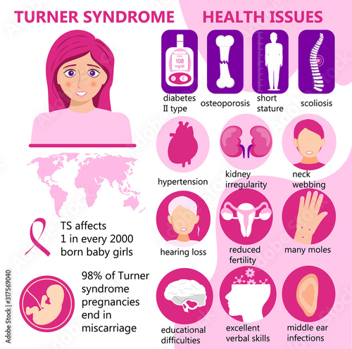 Turner Syndrome infographic vector. Signs, health issues. Short stature, kidney irregularity, reduced fertility, many moles, osteoporosis and diabetes are main problems. TS awareness month.