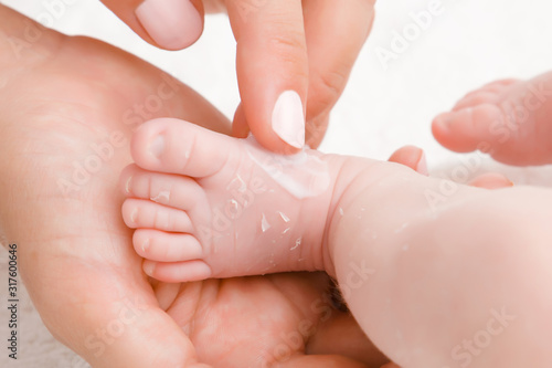 Woman hand holding newborn leg. Mother carefully applying medical ointment on dry skin. First days after birth. Care about baby clean and soft body skin. Close up.