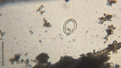 Microscopy of parasite worm nematode (Strongyloides stercoralis). Movement of active parasite infection form in magnification 150x.