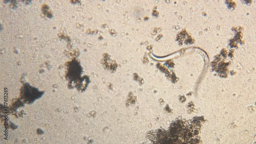 Microscopy of parasite worm nematode (Strongyloides stercoralis). Movement of active parasite infection form in magnification 150x. photo